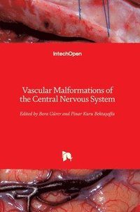 bokomslag Vascular Malformations of the Central Nervous System