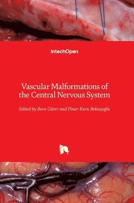 Bora Gürer, Pinar Kuru Bektaşoğlu - Vascular Malformations of the Central Nervous System, Inbunden
