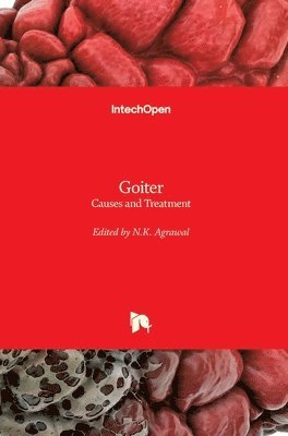 Goiter