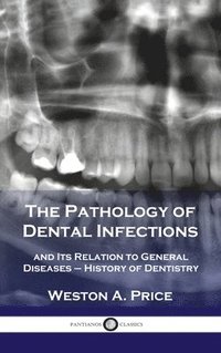 bokomslag Pathology of Dental Infections