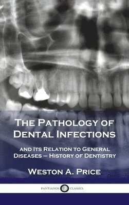 Weston a Price, Weston a. Price, Weston A. Price - Pathology of Dental Infections, Inbunden