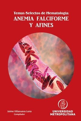 bokomslag Temas Selectos de Hematologa: ANEMIA FALCIFORME Y AFINES