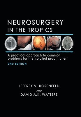Neurosurgery in the Tropics 1