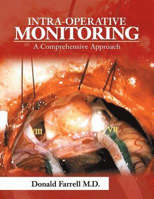 Intra-Operative Monitoring 1