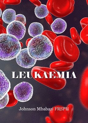 bokomslag Leukaemia