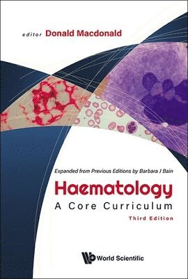 MACDONALD DONALD, Macdonald Donald, Donald Macdonald, Uk) Macdonald, Donald (Imperial College London, Donald MacDonald - Haematology: A Core Curriculum (Third Edition), Häftad