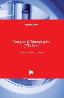 Computed-Tomography (CT) Scan 1