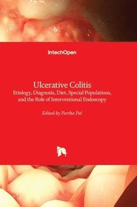 bokomslag Ulcerative Colitis