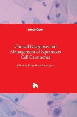 Clinical Diagnosis and Management of Squamous Cell Carcinoma 1