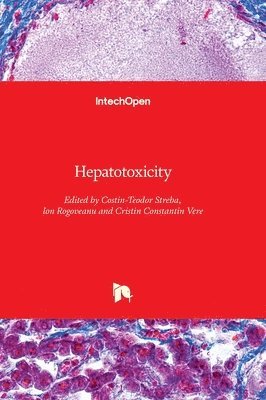 Hepatotoxicity 1