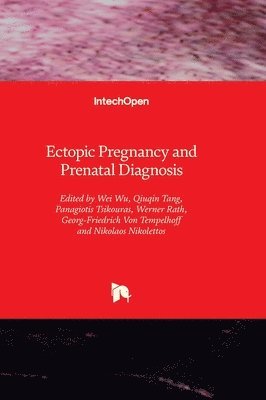 bokomslag Ectopic Pregnancy and Prenatal Diagnosis