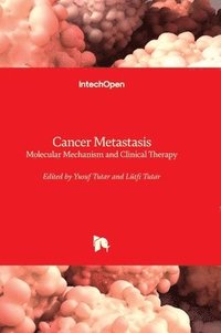 bokomslag Cancer Metastasis