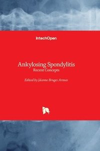 bokomslag Ankylosing Spondylitis