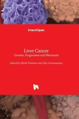 bokomslag Liver Cancer