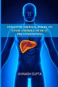 bokomslag Effect of thermal injury on liver and role of heat preconditioning