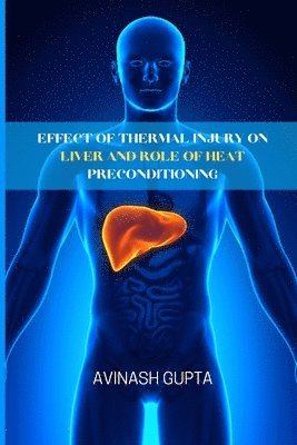 Effect of thermal injury on liver and role of heat preconditioning 1