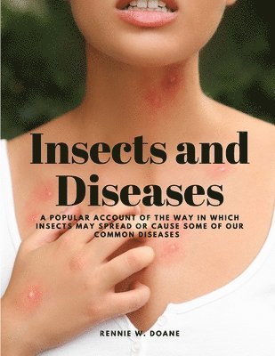 Insects and Diseases - A Popular Account of the Way in Which Insects may Spread or Cause some of our Common Diseases 1