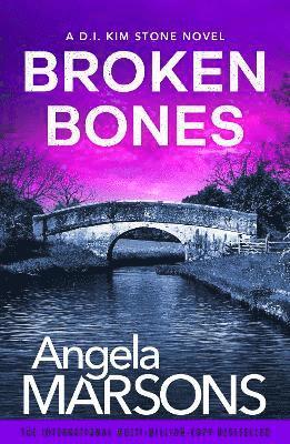 Broken Bones