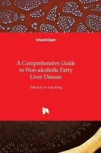bokomslag A Comprehensive Guide to Non-alcoholic Fatty Liver Disease