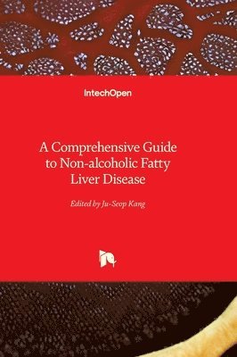 Ju-Seop Kang - Comprehensive Guide to Non-alcoholic Fatty Liver Disease, Inbunden