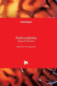 bokomslag Hydrocephalus