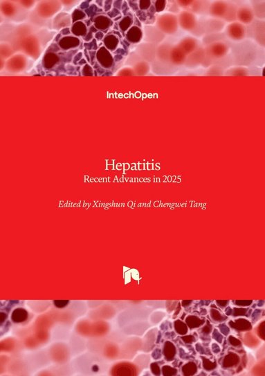Chengwei Tang, Xingshun Qi, Xingshun Qi, Chengwei Tang - Hepatitis, Inbunden