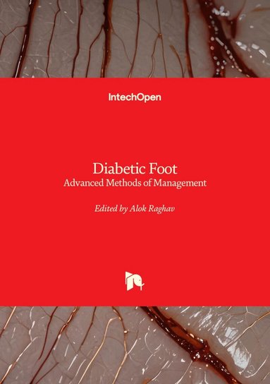 Alok Raghav, Alok Raghav - Diabetic Foot, Inbunden
