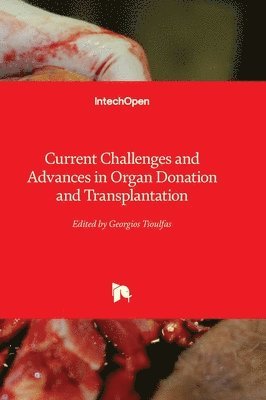 Current Challenges and Advances in Organ Donation and Transplantation 1