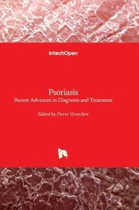 bokomslag Psoriasis - Recent Advances in Diagnosis and Treatment