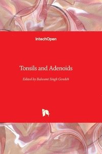 bokomslag Tonsils and Adenoids