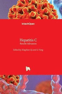 bokomslag Hepatitis C