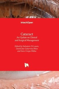 bokomslag Cataract