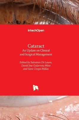 Cataract 1