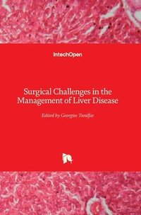 bokomslag Surgical Challenges in the Management of Liver Disease