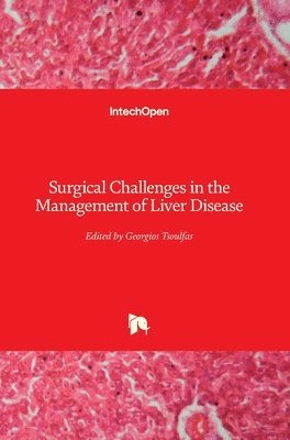 Georgios Tsoulfas - Surgical Challenges in the Management of Liver Disease, Inbunden