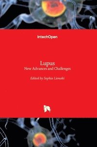 bokomslag Lupus