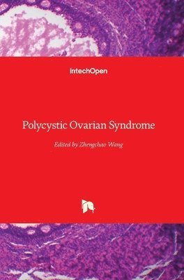 bokomslag Polycystic Ovarian Syndrome