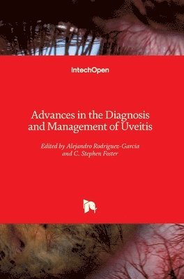 Alejandro Rodriguez-Garcia, C. Stephen Foster - Advances in the Diagnosis and Management of Uveitis, Inbunden