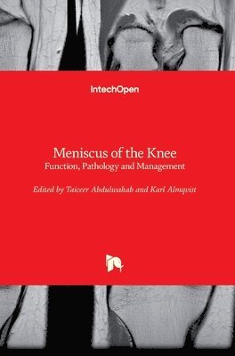 Meniscus of the Knee 1