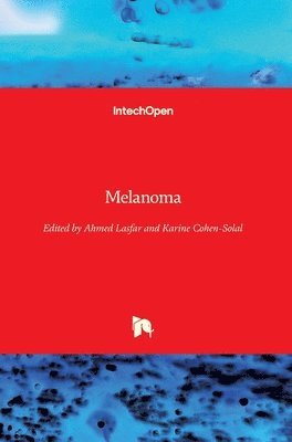 Karine Cohen-Solal, Ahmed Lasfar - Melanoma, Inbunden