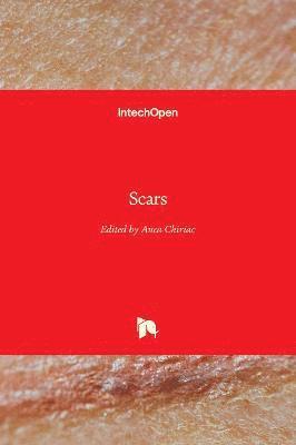 Scars 1