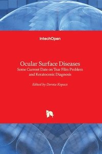 bokomslag Ocular Surface Diseases