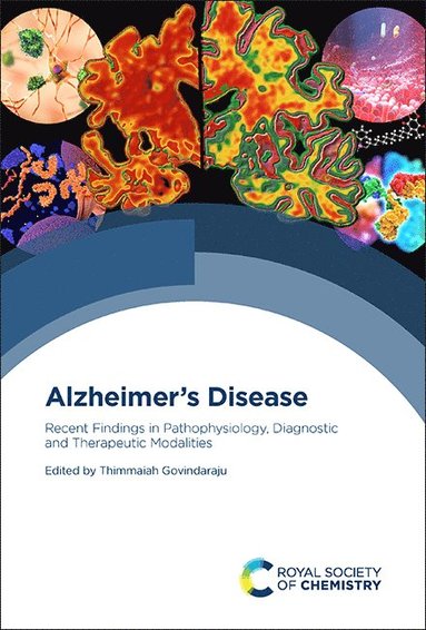 bokomslag Alzheimer's Disease