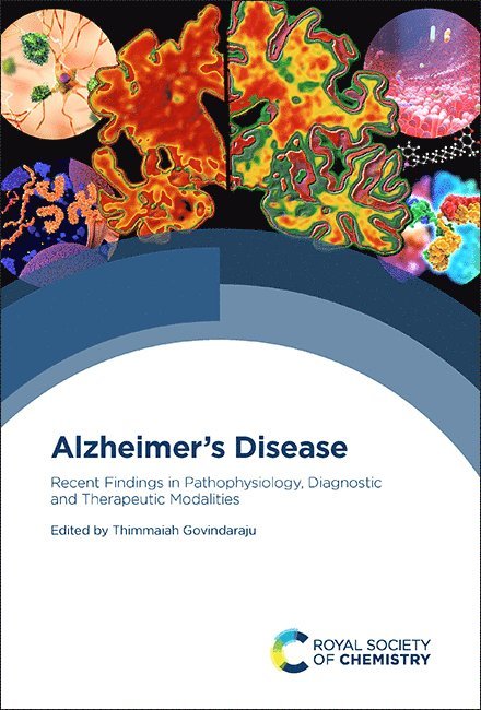Alzheimer's Disease