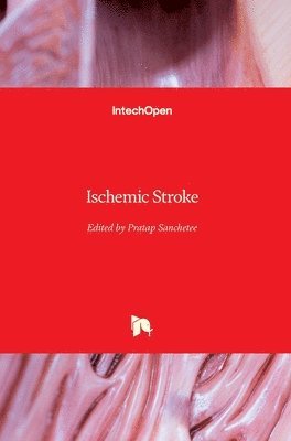 Pratap Sanchetee - Ischemic Stroke, Inbunden