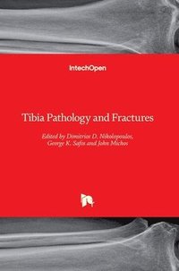 bokomslag Tibia Pathology and Fractures