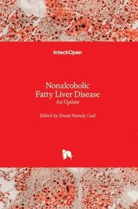bokomslag Nonalcoholic Fatty Liver Disease