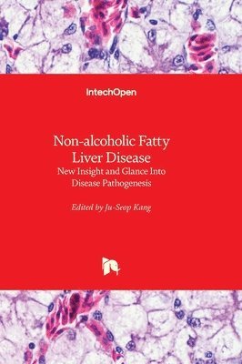 bokomslag Non-alcoholic Fatty Liver Disease