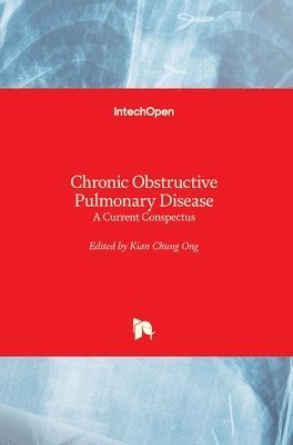 Kian Chung Ong - Chronic Obstructive Pulmonary Disease, Inbunden