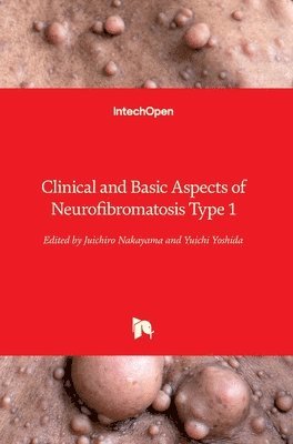 bokomslag Clinical and Basic Aspects of Neurofibromatosis Type 1